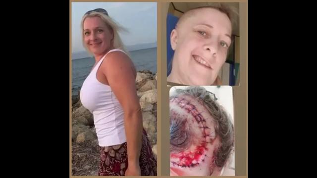 COMPILATION OF THE DEAD AND DYING FROM THE COVID VACCINATIONS VIDEO 22