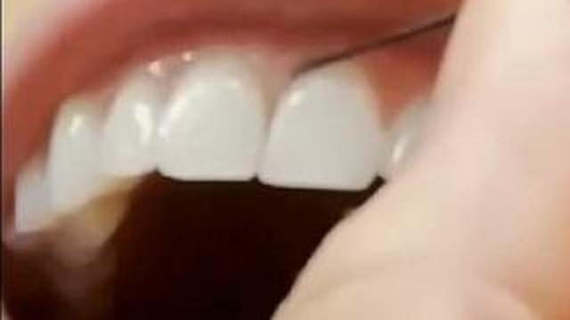 Dental Floss Vaccines